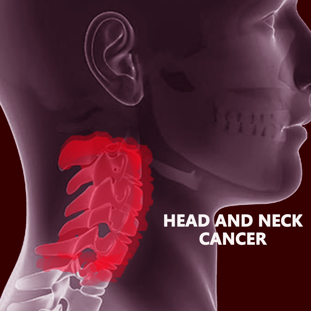 Best Cancer Hospital In India Head And Neck Cancer Treatment In